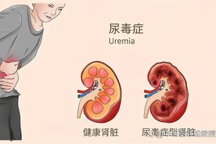 孔塞桑：塔雷米将为波尔图效力到6月份 今天我支持国米